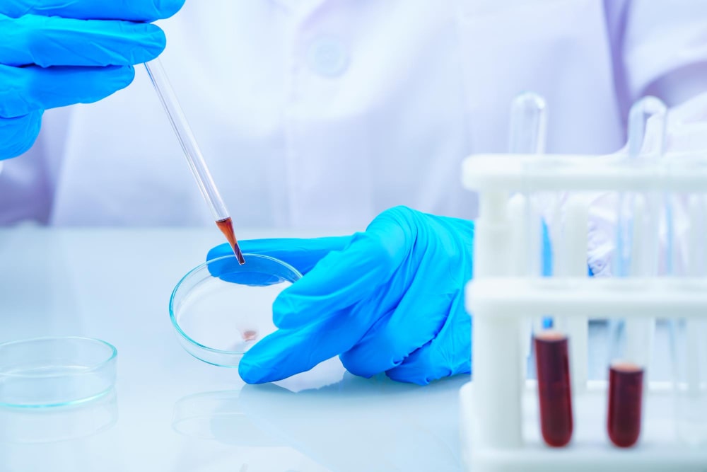 Badanie krwi na pasożyty - na czym polega?