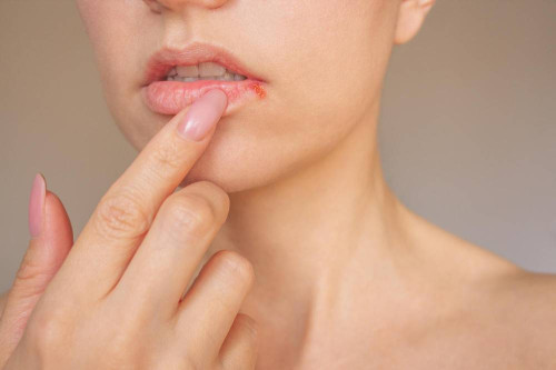 Czym spowodowane są spuchnięte usta?